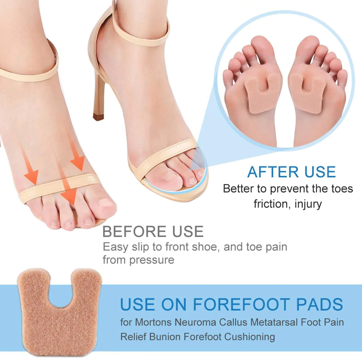 South Moon Durable Forefoot Pads for Pain Relief
