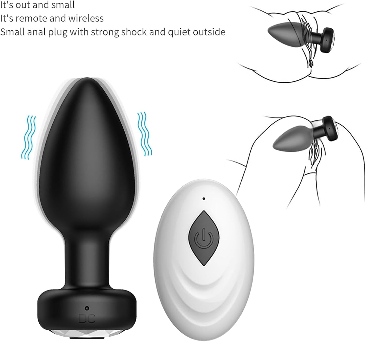MidnightWhisper Remote Prostate Anal Plug-1