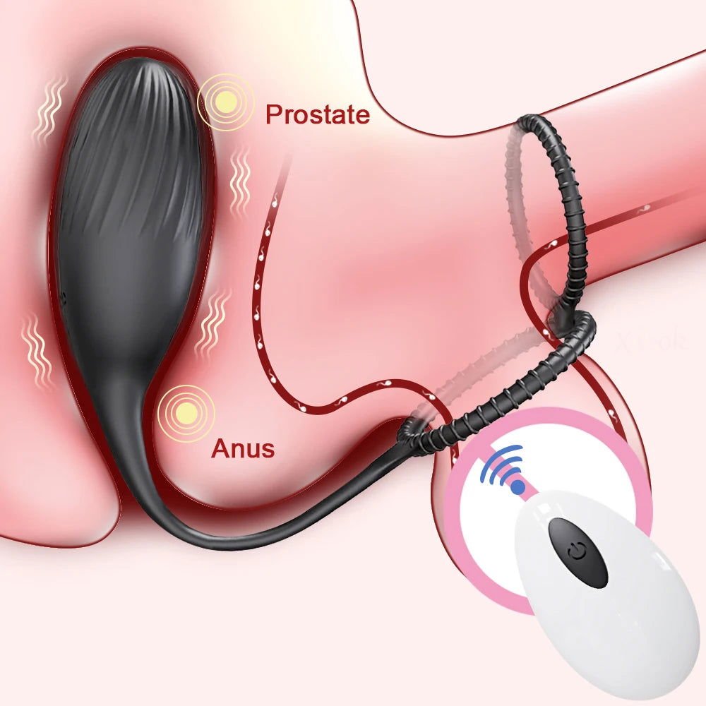 Wireless Control Prostate Massager Cock Ring-1