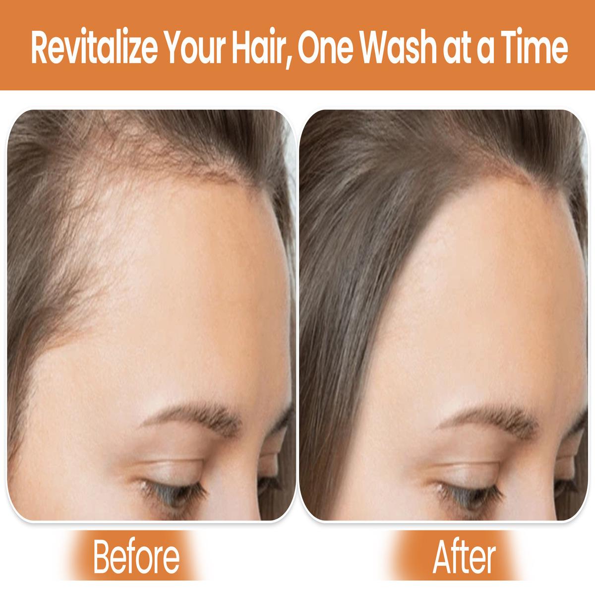 Biotin Shampoo & Conditioner-2