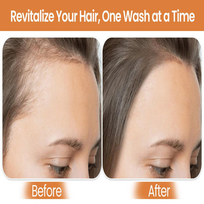 Biotin Shampoo & Conditioner-2