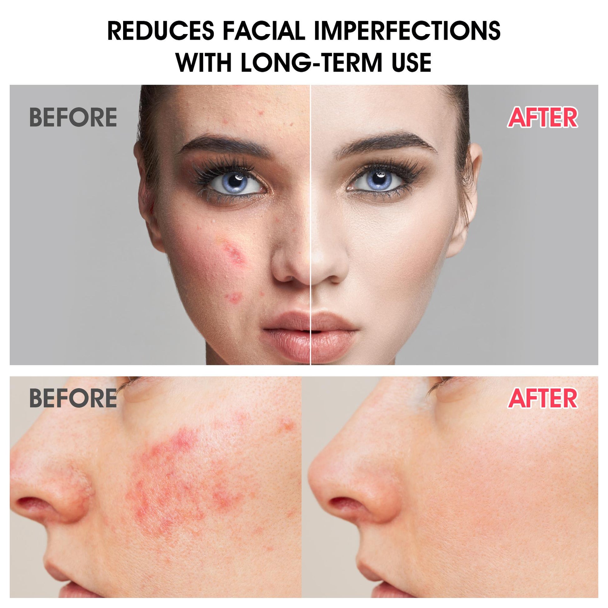 Alpha Arbutin Face Serum-4