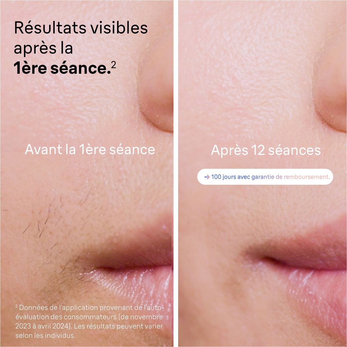 Electric Hair Remover Braun PL7253-4