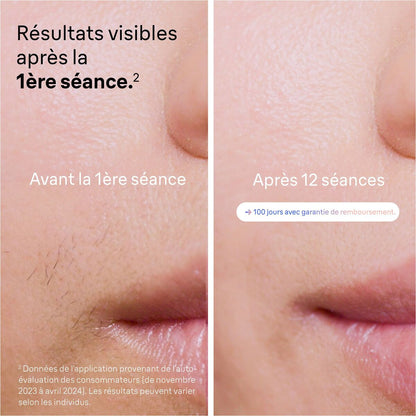 Electric Hair Remover Braun PL7253-4