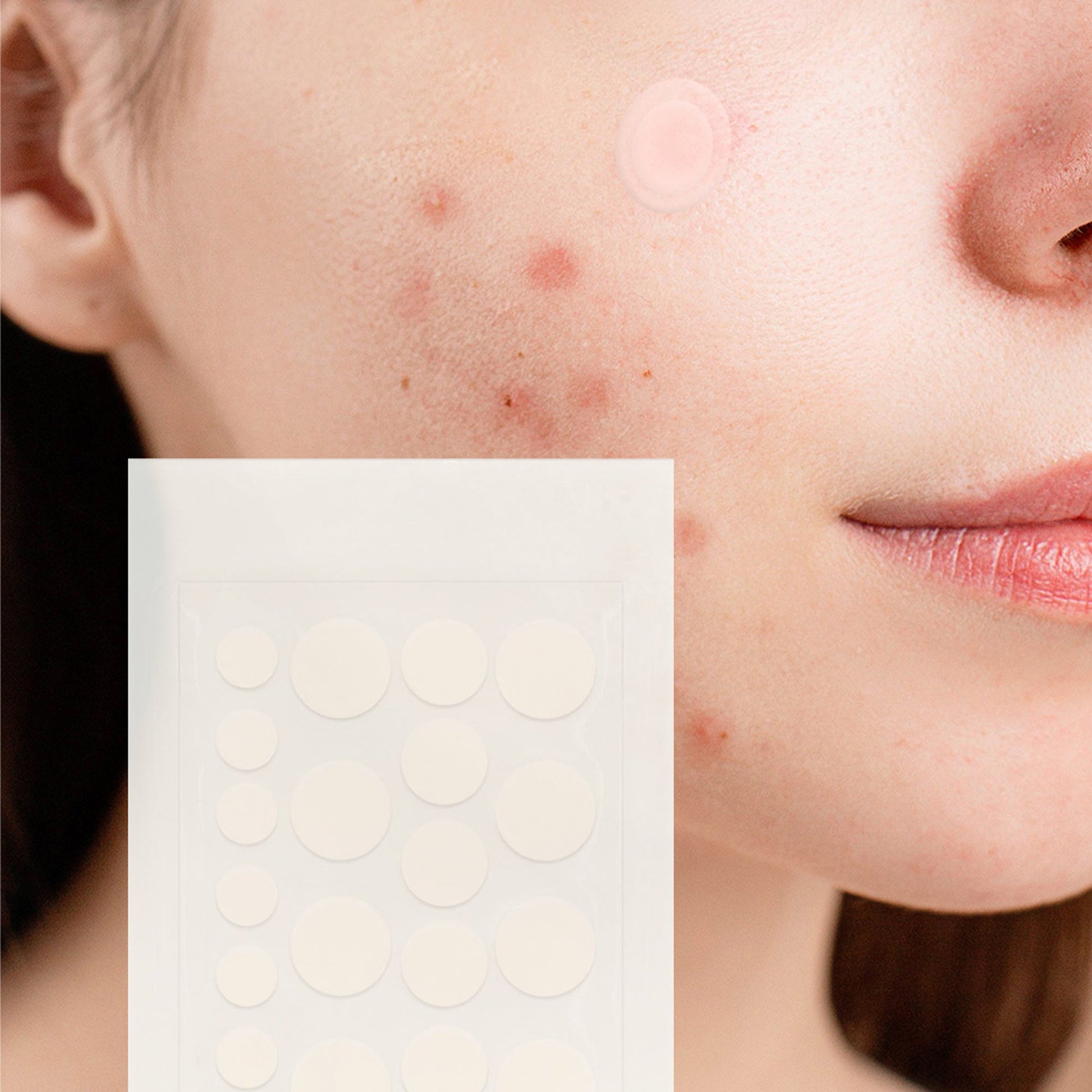 Hydrocolloid Pimple Patch, 120-Count, Multi Size Acne Solution 5 Pack-3