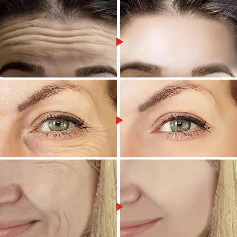 Instant Wrinkle Remover-1