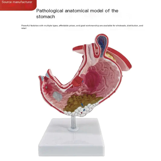 Human Gastrointestinal Anatomy Model for Medical Display