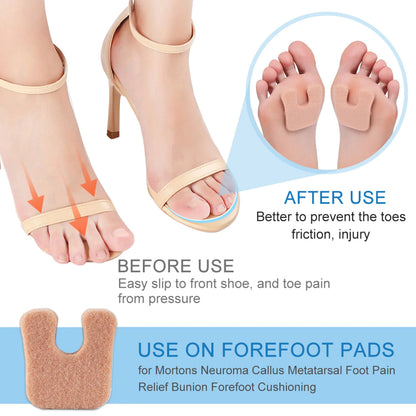 South Moon Durable Forefoot Pads for Pain Relief